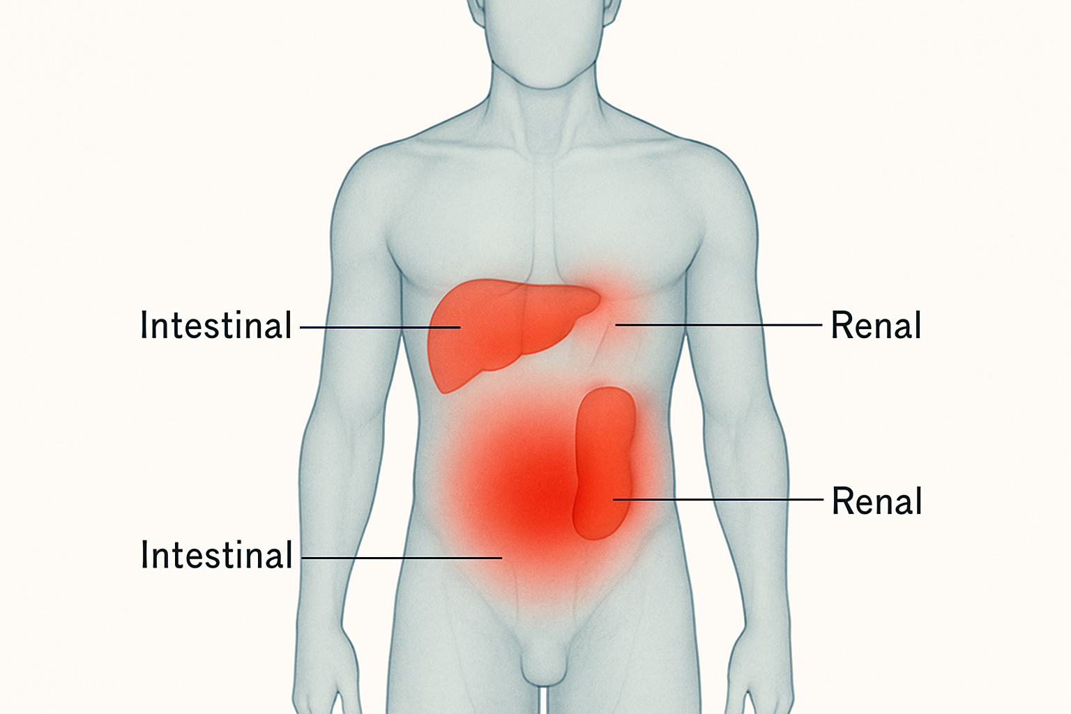 Colique chez l'adulte - zones de douleur abdominale selon le type de colique