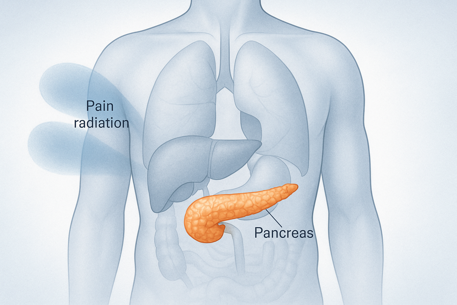 Douleur au pancréas : illustration anatomique montrant la localisation et l'irradiation de la douleur pancréatique